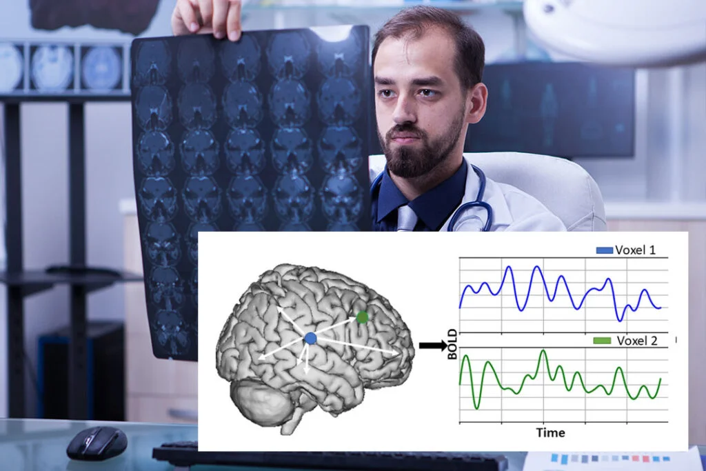 Brain disorder graph